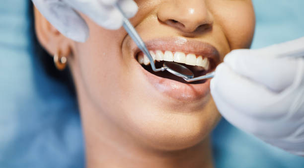 Best Knocked-Out Tooth Emergency  in Keystone, FL
